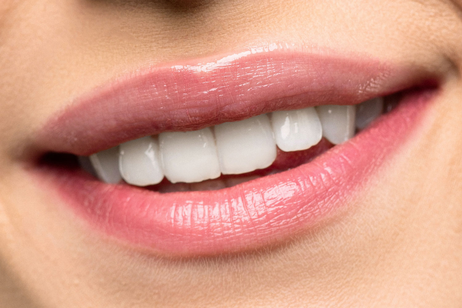 zambet-stralucitor-shine-albire-dinti-02