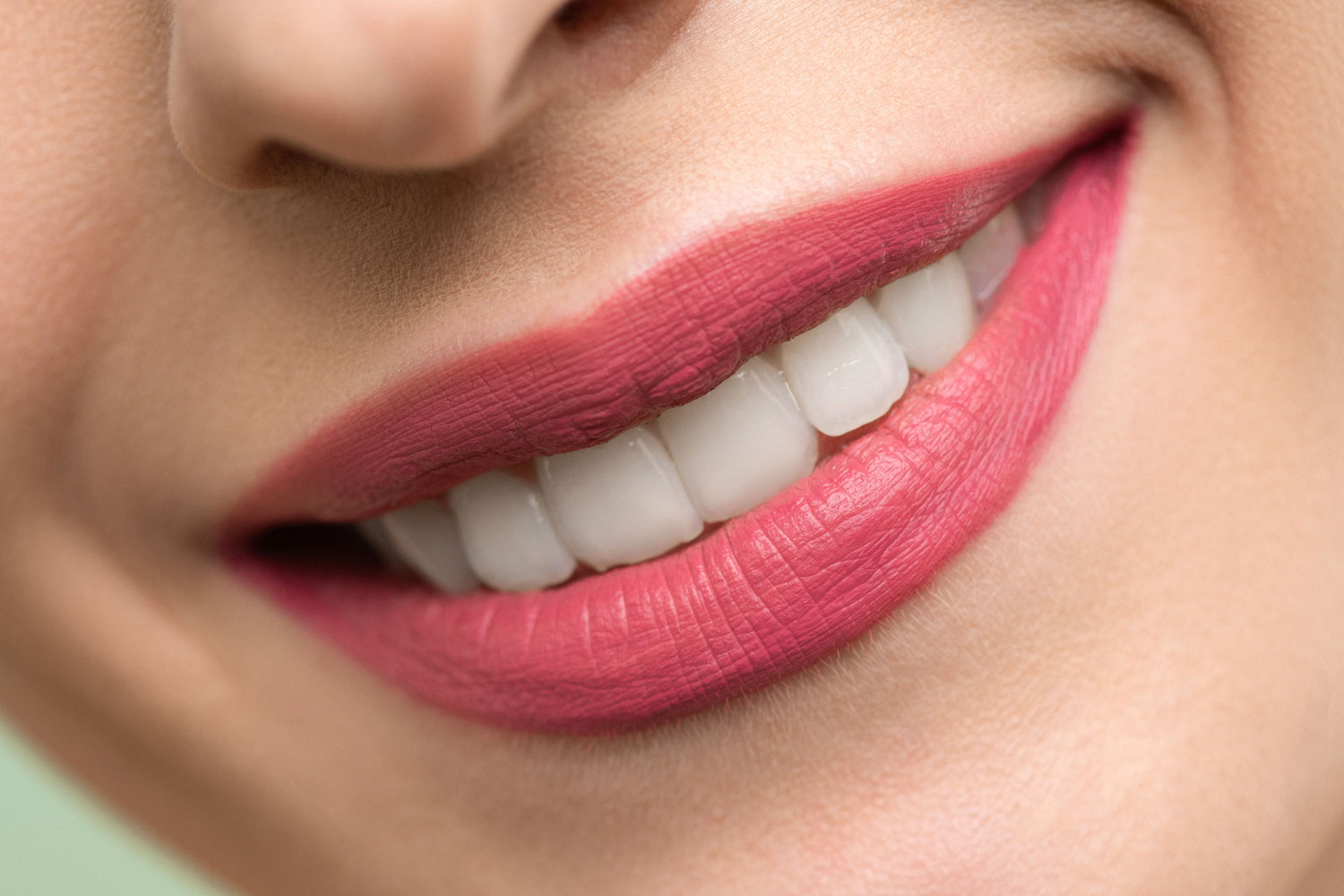 zambet-stralucitor-shine-albire-dinti