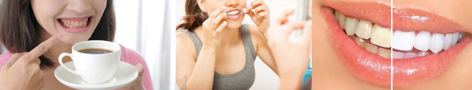 benzi-albire-wide-models